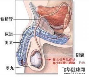 尿疼得上了附睾丸炎怎么办