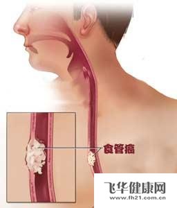 常常干咳是什么缘故原由
