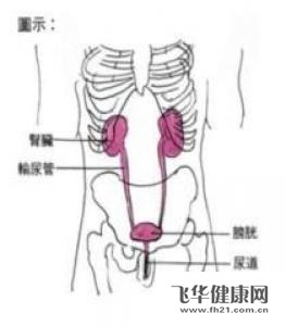 3岁独肾先天性畸形尿失禁输尿管异位怎么办