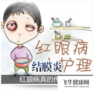 过敏性结膜炎会有哪些并发症吗