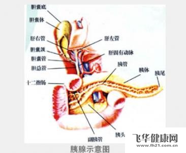 水肿型急性胰腺炎怎么治疗