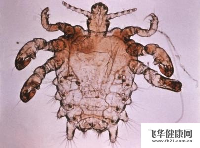阴虱会跑到头上变头虱吗