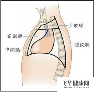 治疗纵隔囊肿及肿瘤的办法是什么