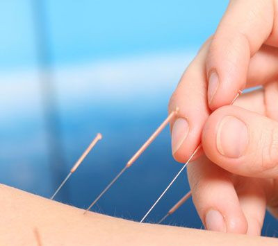 五极失眠针灸有效吗