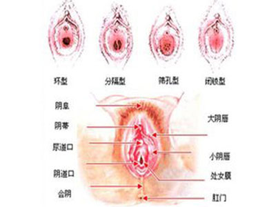 健康女性的私处会散发什么气味?