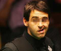 轻微面瘫的症状与治疗方法(推荐),轻微面瘫的症