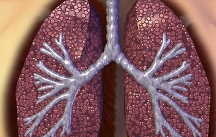 肺大泡是肺气肿吗