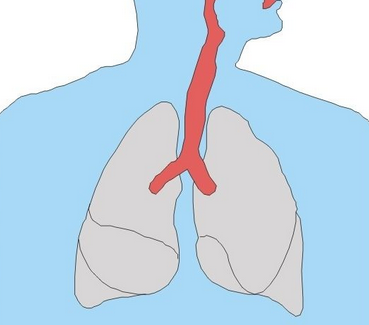 肺部支气管扩张是一种什么病