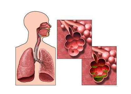 治疗肺气肿的专业医院怎么治疗肺气肿
