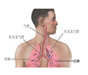 肺脓肿以及肺结核等的防治,对预防支气管扩张症的发生具有重要意义