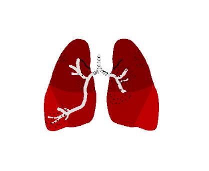 肺纤维化的起因是什么