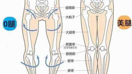 得了o型腿会遗传吗