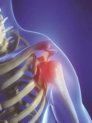 肩周炎中医诊断是什么