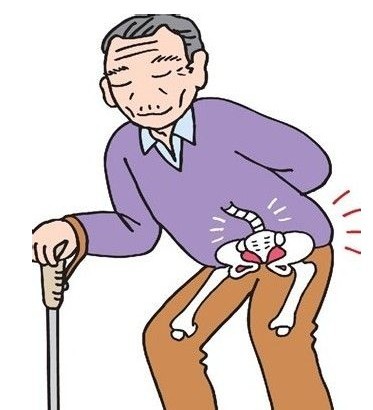 坐骨神经痛是什么症状