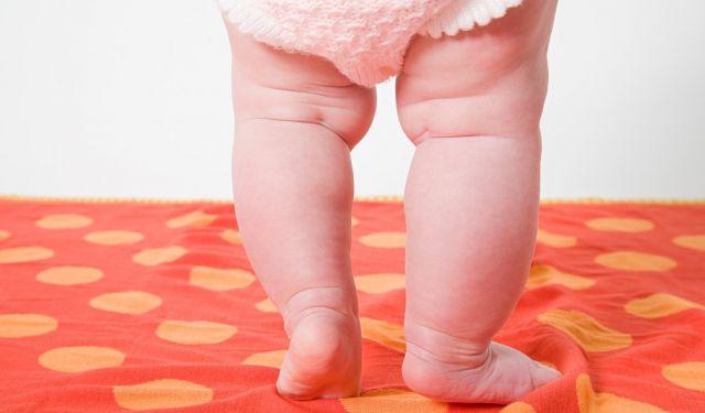 什么是罗圈腿,什么是罗圈腿图片,宝宝为什么是罗圈腿