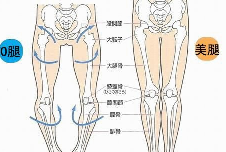 怎么治疗o型腿呢