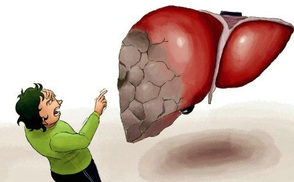 得了肝硬化能活多久