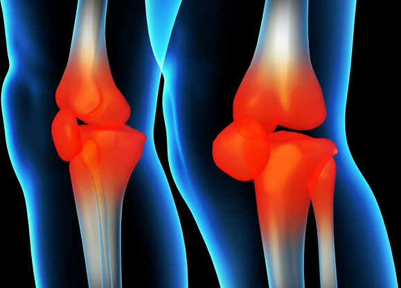 骨性膝关节炎手术治疗方法有哪些