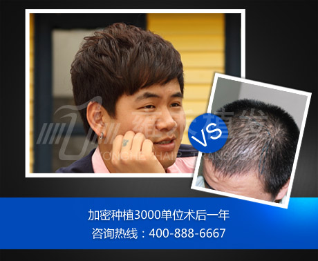3000加密.jpg