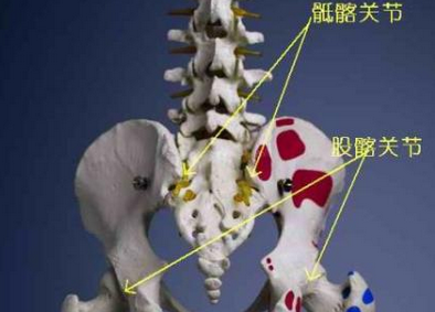 骶髂骨关节炎能治好吗