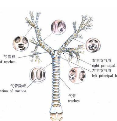 支气管扩张是以局部支气管不可逆性解剖结构异常为特征,是由于支