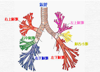 支气管扩张会遗传后代吗