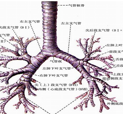 诊断支气管扩张的项目都有哪些