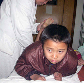 小儿麻痹症困扰着患者和患者的父母亲,因此在孩子还是儿童时期的时候