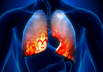 如何预防呼吸机相关性肺炎