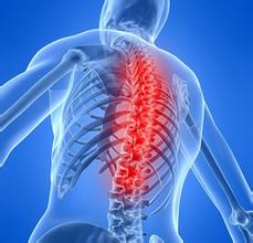 强直性脊柱炎临床治愈标准是什么