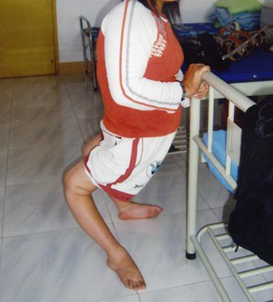 小儿麻痹症后遗症腿细的治疗方法