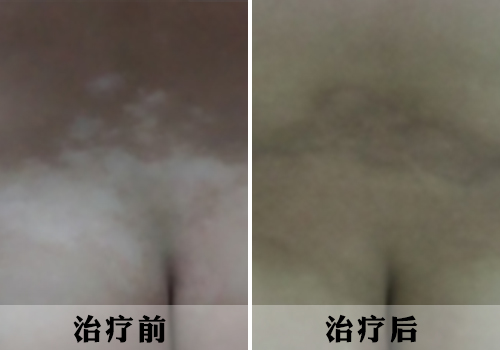 wpsF8CA_tmp.png
