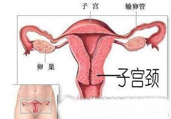 慢性子宫颈炎可吃海鲜吗 - 飞华健康网