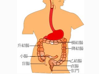 大肠癌发作特点有哪些