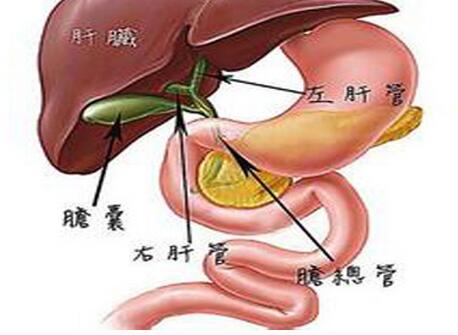 胆囊癌手术费用是多少