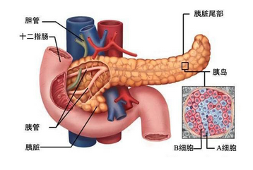 胰腺癌手术后遗症