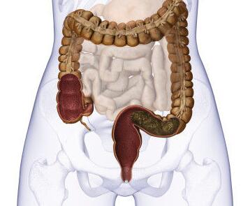 患结直肠癌的原因