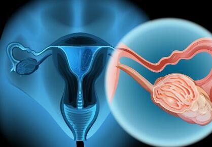 子宫癌的早期症状可以治好吗
