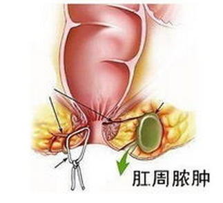 2,无痛肛门镜检查,检查一步到位:医院肛肠中心