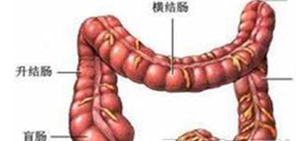 直肠息肉的中西医治疗方法