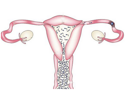 女性输卵管堵塞检查费用
