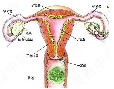 输卵管炎和输卵管癌区别