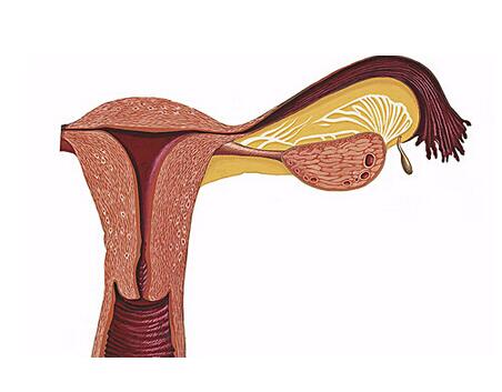 功能性子宫出血