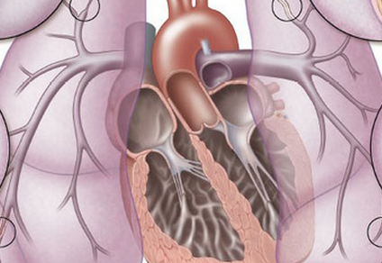 肺动脉高压的超声诊断标准
