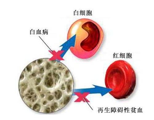 贫血是什么原理呢