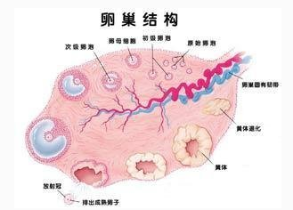 女性患多囊卵巢综合征的原因是什么