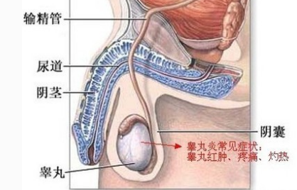 哪些中成药可治睾丸炎