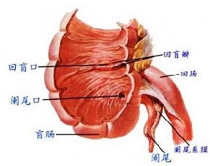 应注意排除其他回盲部疾病,如肿瘤,结核,非特异性盲肠炎,克罗恩氏病及