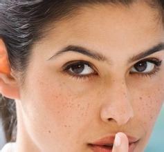 女性面部色斑为何容易反复_飞华健康网