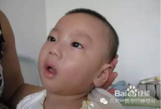 小儿.jpg